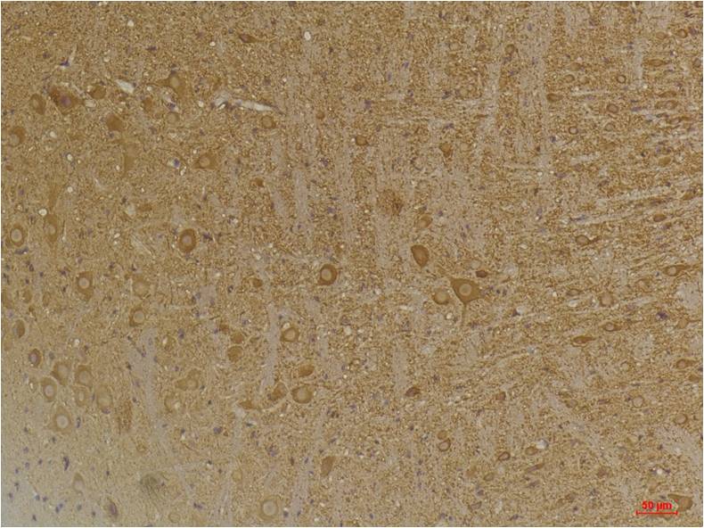GABA B Receptor 2 Polyclonal Antibody (A228)