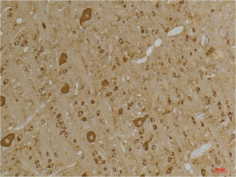 GABA A Receptor Gamma2 Polyclonal Antibody (A229)