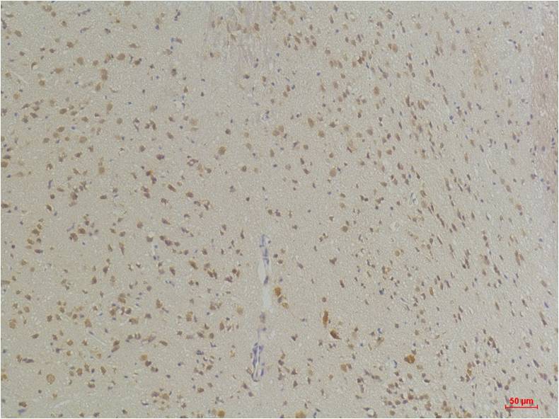GABA Transporter 1 Polyclonal Antibody (A230)