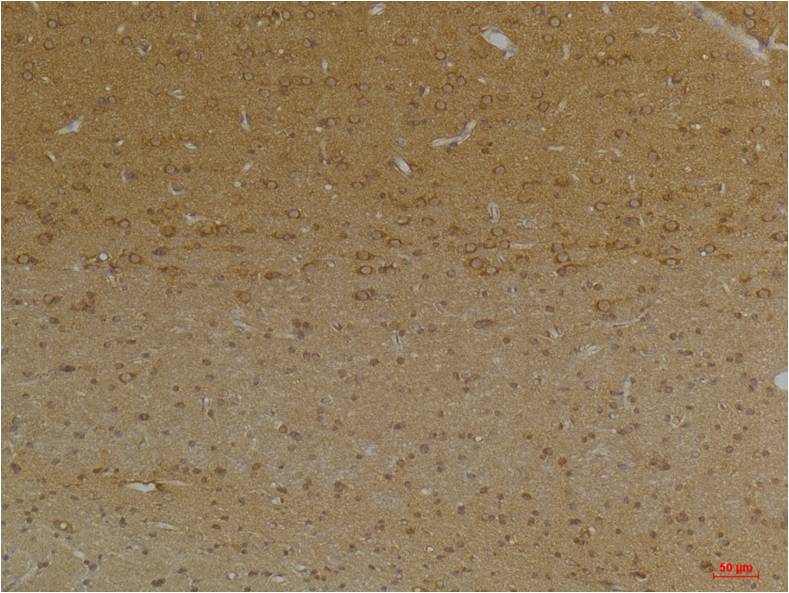 KCNK9 (TASK-3) Polyclonal Antibody (A239)