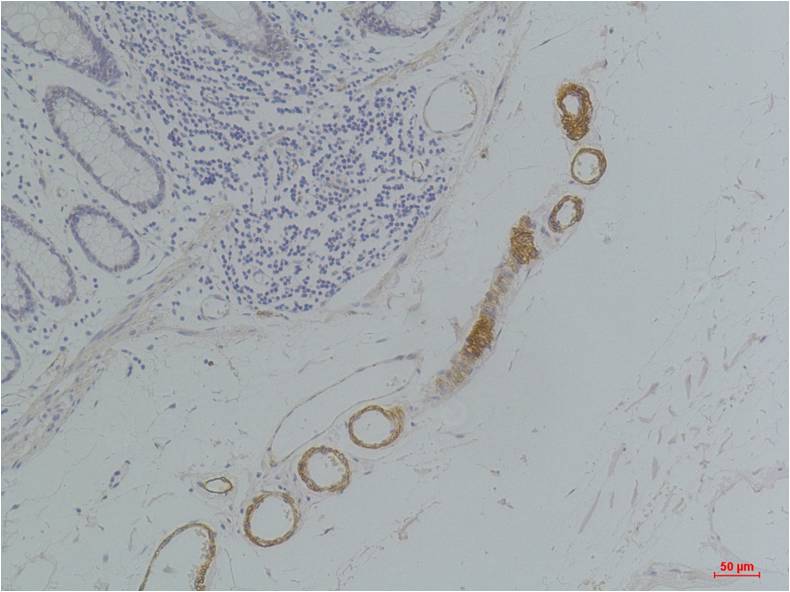 GRIK2 (GluR6) Polyclonal Antibody (A240)