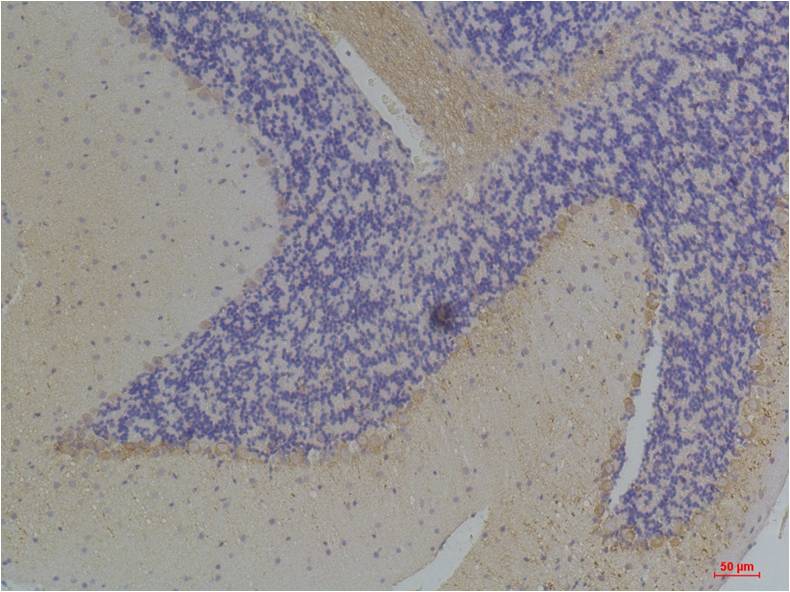 KChIP3 Polyclonal Antibody (A250)