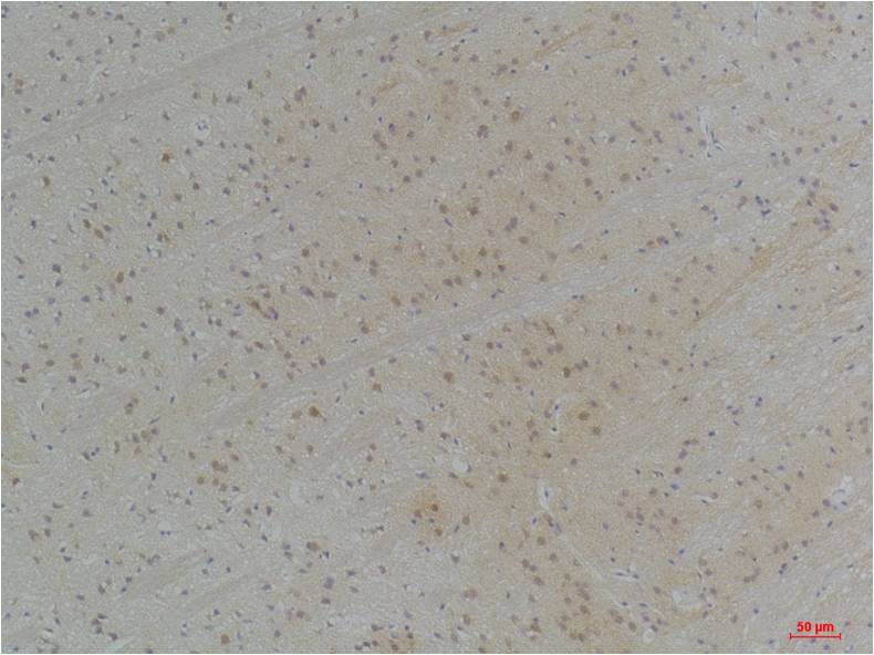 KVBeta1 Polyclonal Antibody (A255)