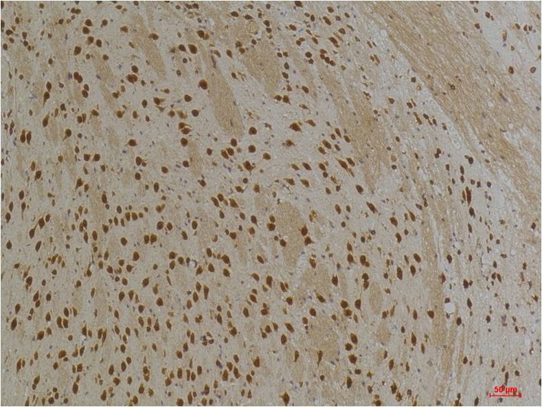 KV10.1 Polyclonal Antibody (A259)