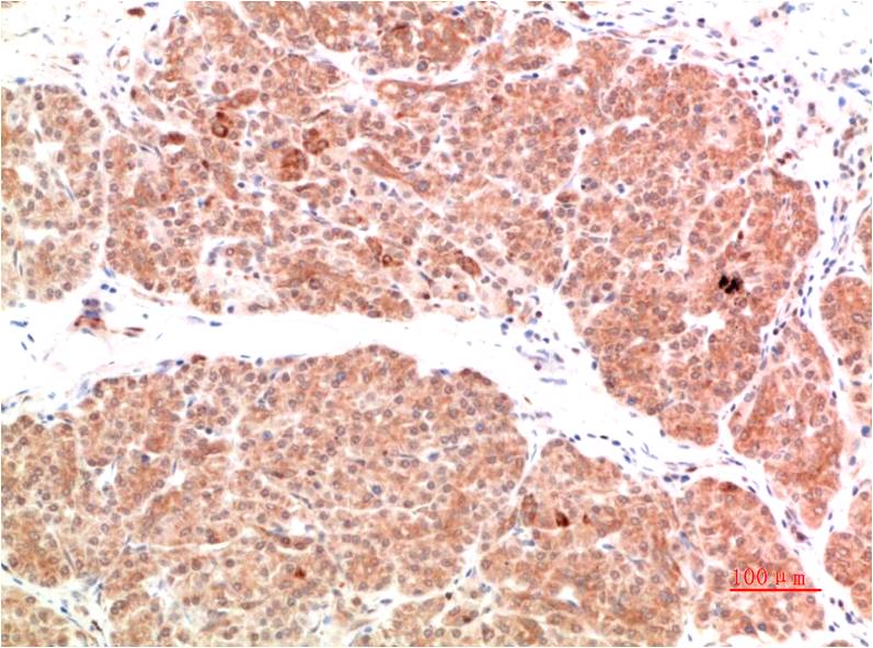 PI3 Kinase P85 Polyclonal Antibody (PI3K p85)