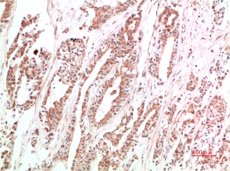 VEGF Polyclonal Antibody (VEGF)