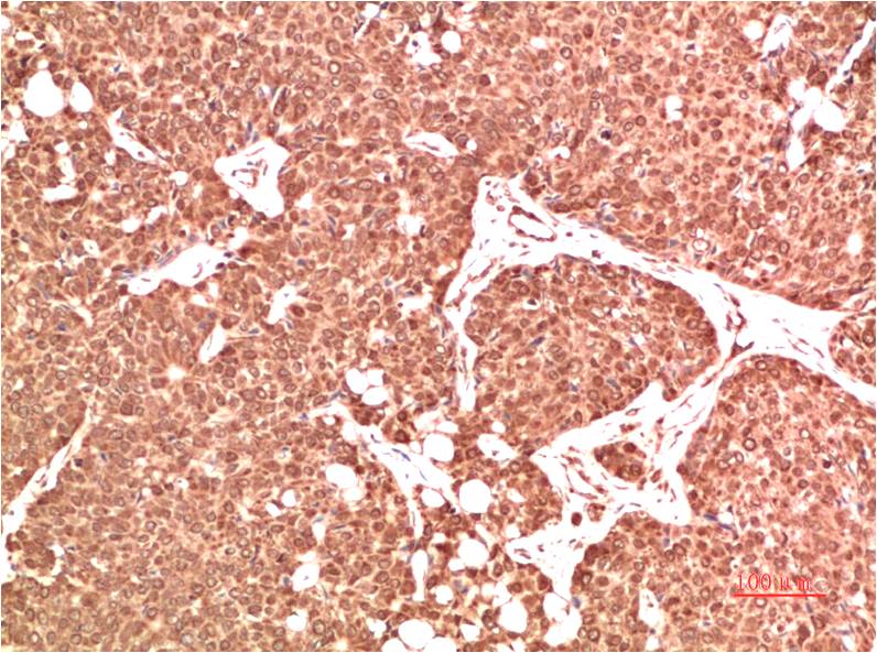 ATM Polyclonal Antibody (ATM-1)