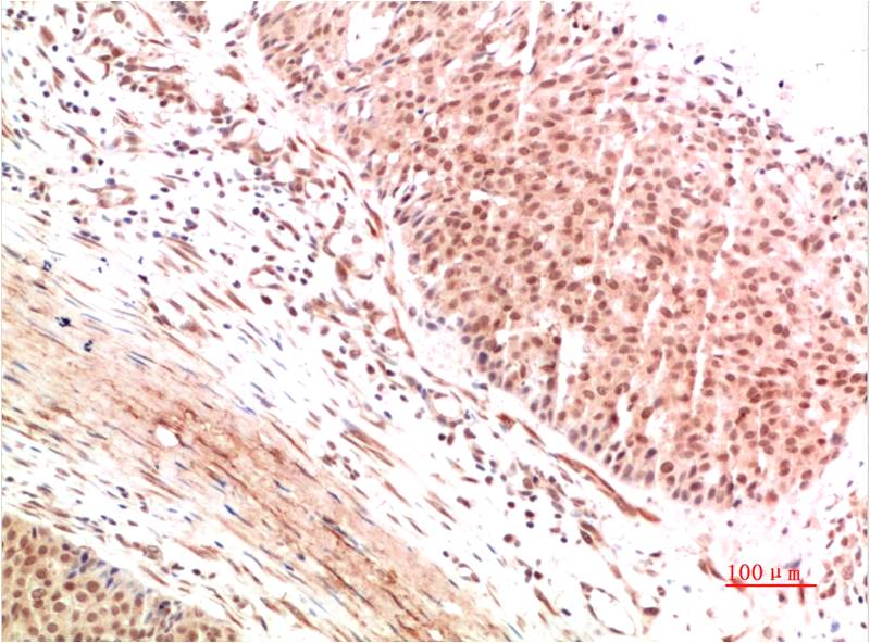 ATM Polyclonal Antibody (ATM-2)