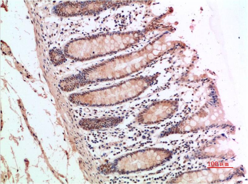 ATM Polyclonal Antibody (ATM-2)
