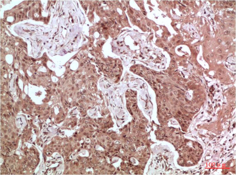 Acetyl-CoA Carboxylase Polyclonal Antibody (F104)