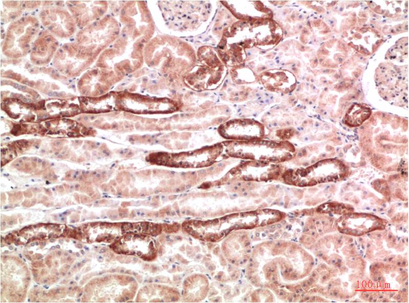 AMPK Gamma1 Polyclonal Antibody (F114)