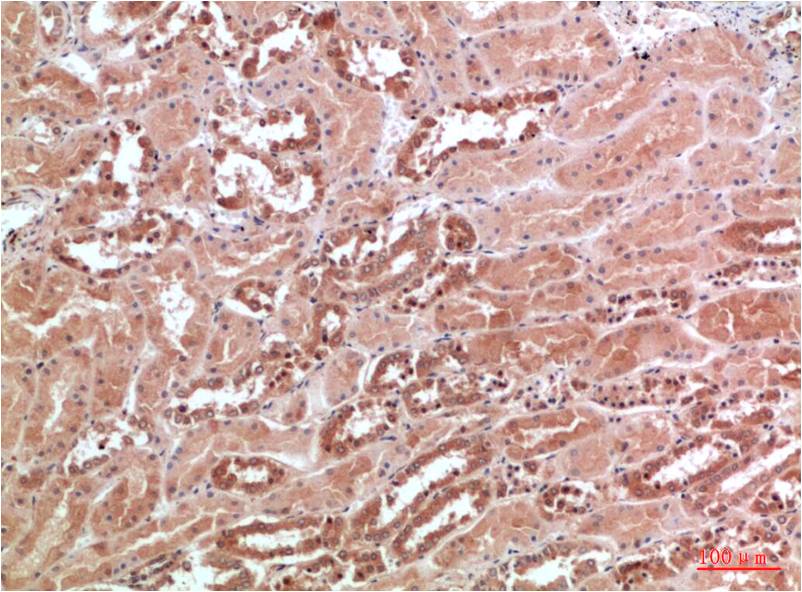 AMPK Gamma1 Polyclonal Antibody (F115)