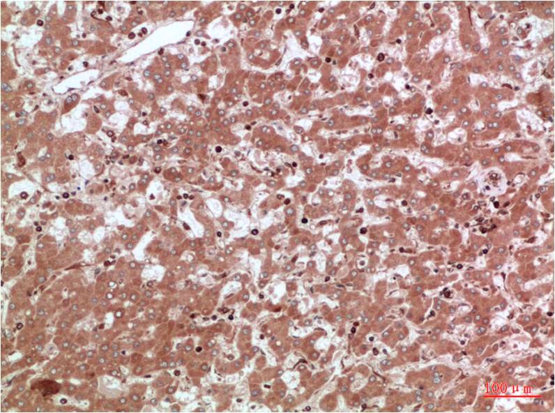 AMPK Alpha2 Polyclonal Antibody (F117)
