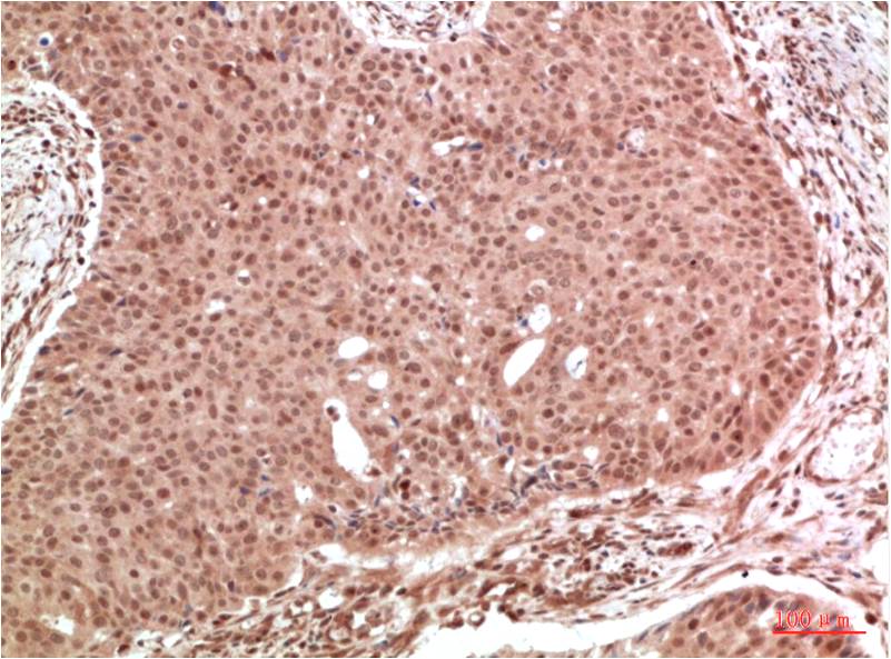 MAPK (ERK1 2) Polyclonal Antibody (F136)