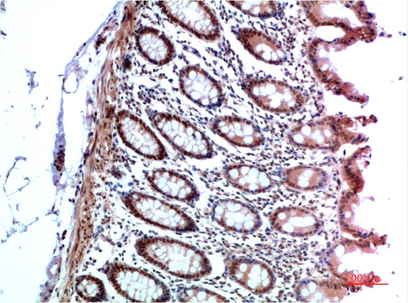 HP-1 Alpha Polyclonal Antibody (HP-1 a)