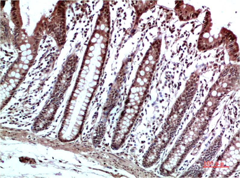 HP-1 Gamma Polyclonal Antibody (HP-1 g)