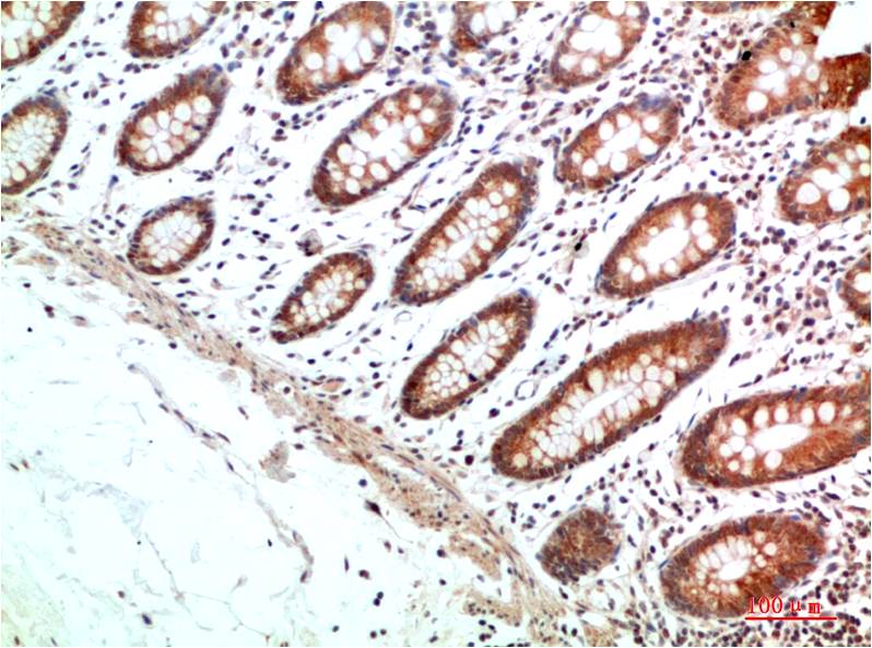 HIF-1Alpha Polyclonal Antibody (F148)