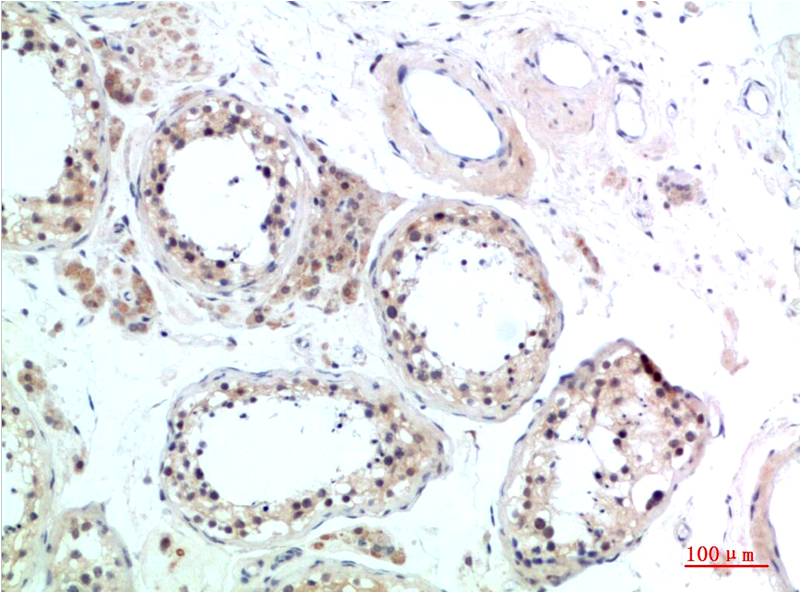 HSC70 Polyclonal Antibody (F155)