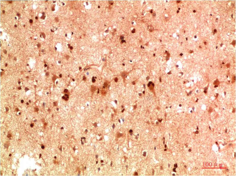 HSP40 Polyclonal Antibody (F158)