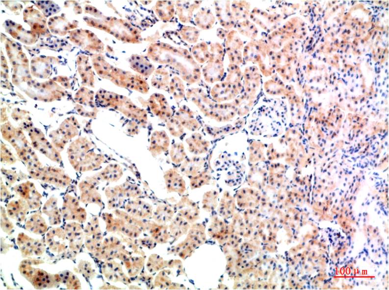 IkB Alpha Polyclonal Antibody (F168)