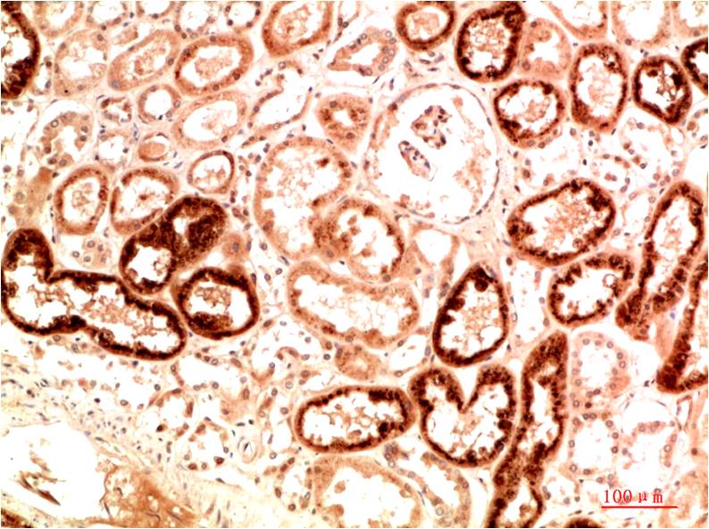 Nrf2 Polyclonal Antibody (F292)