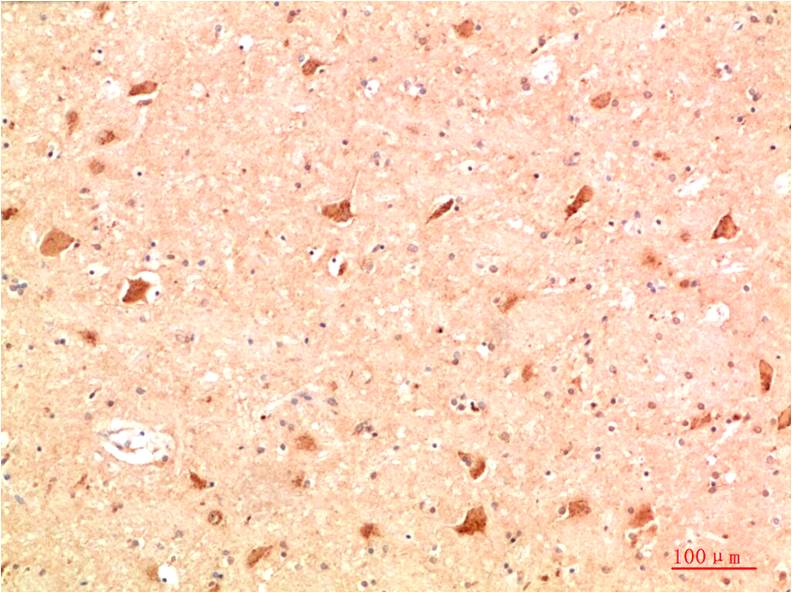 ATG4a Polyclonal Antibody (F303)