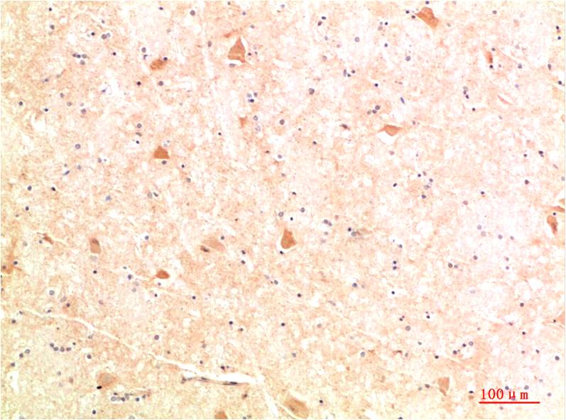 ATG4b Polyclonal Antibody (F304)