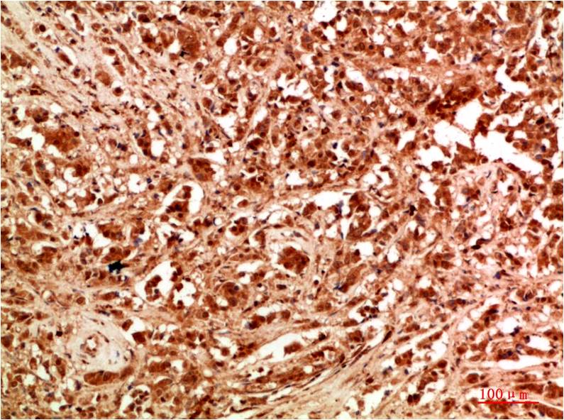 ATG7 Polyclonal Antibody (F309)