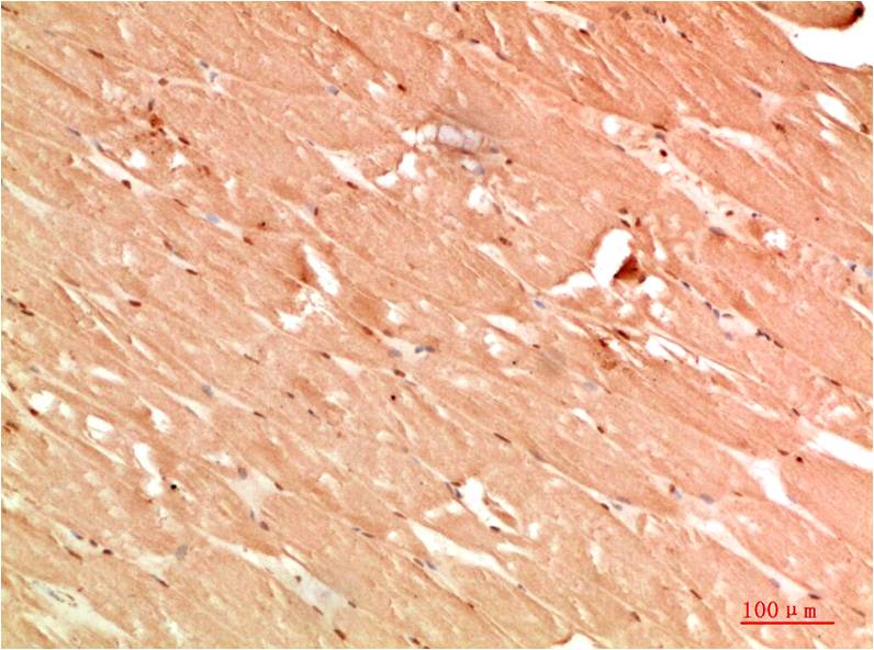 ATG13 Polyclonal Antibody (F310)