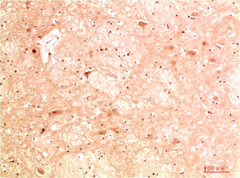 ATG13 Polyclonal Antibody (F310)