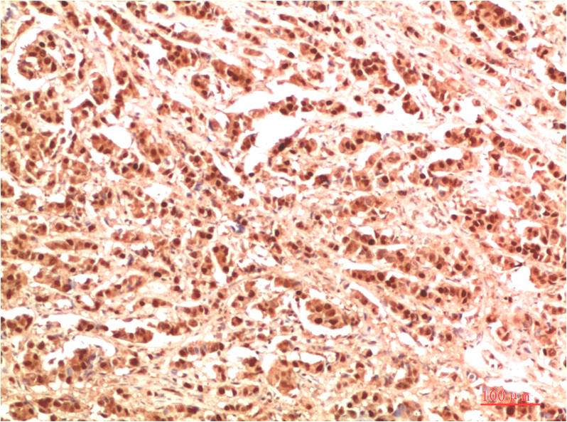 NBR1 Polyclonal Antibody (F317)