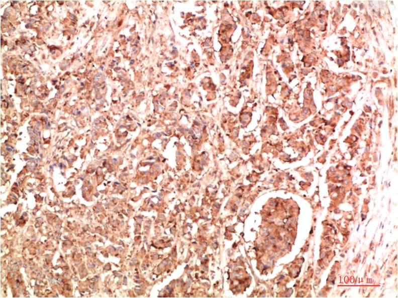 NBR1 Polyclonal Antibody (F318)