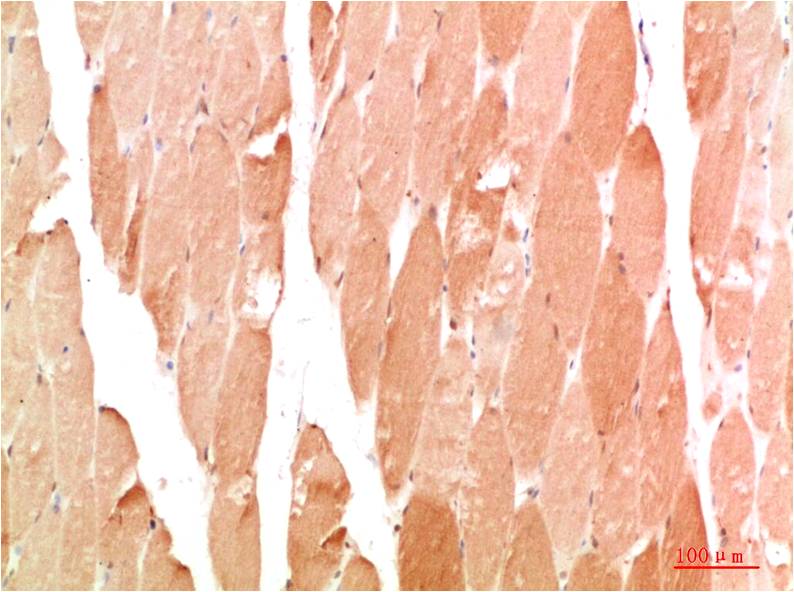 WIPI2 Polyclonal Antibody (F327)
