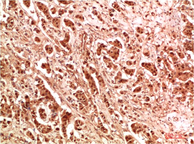WIPI2 Polyclonal Antibody (F327)