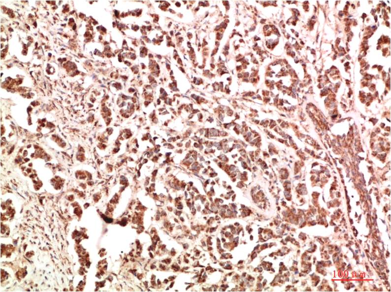 FAK Polyclonal Antibody (F345)