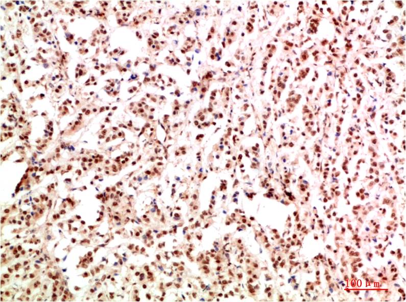 Gab1 Polyclonal Antibody (F349)