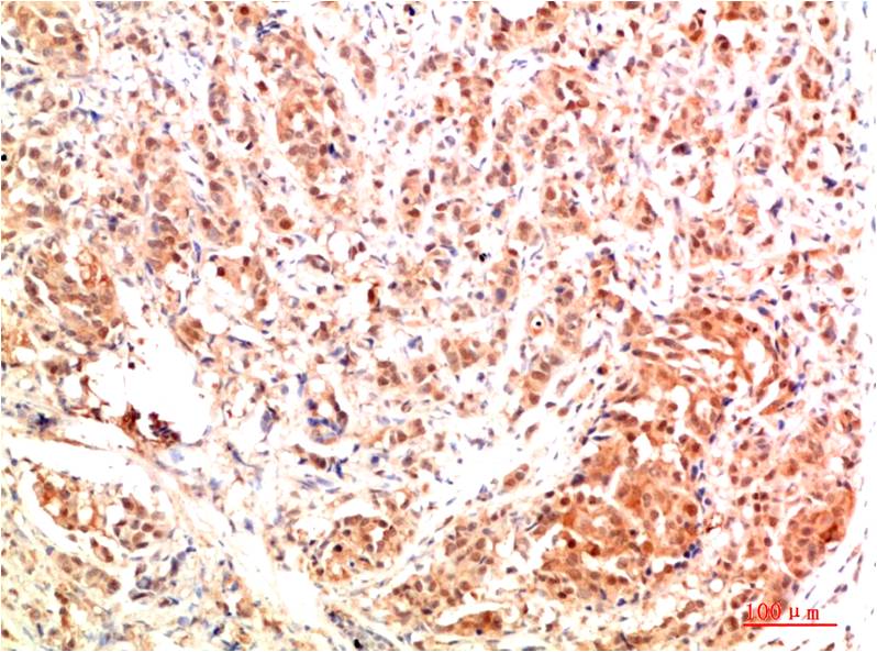 ERK1 Polyclonal Antibody (ERK1)