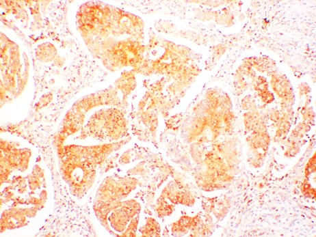 HSP90 Alpha Polyclonal Antibody