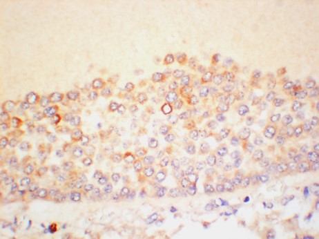 AMH Polyclonal Antibody
