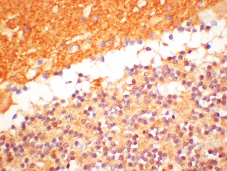 alpha-Syneuclein Polyclonal Antibody