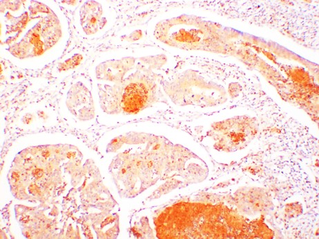 TRIM21 Polyclonal Antibody