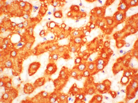 HSD11B1 Polyclonal Antibody