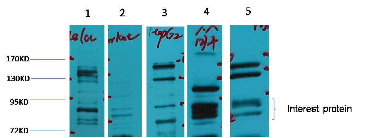 Glucocorticoid receptor Polyclonal Antibody