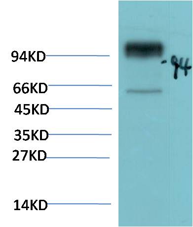 ACE2 Polyclonal Antibody