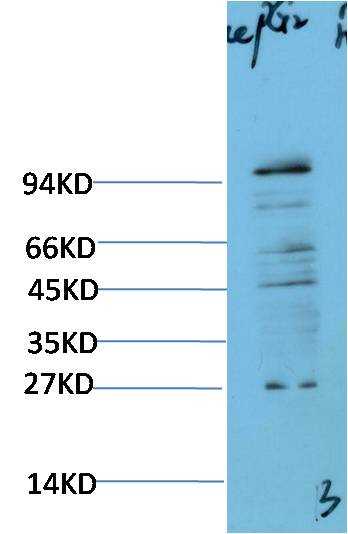 ACE2 Polyclonal Antibody
