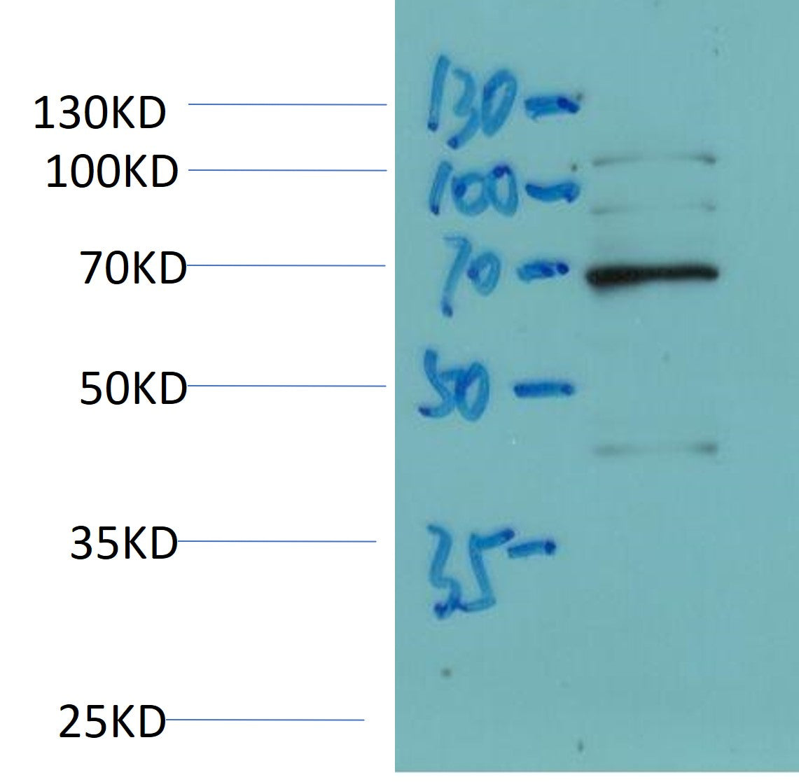 SPHK2 Polyclonal Antibody