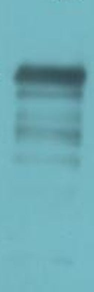 Bombesin Receptor 2 Polyclonal Antibody (A187)