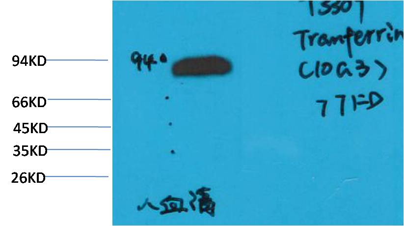Transferrin Monoclonal Antibody (10G3)