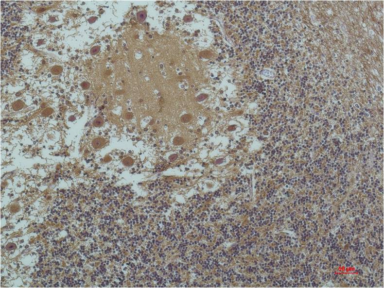 Alpha-tubulin (Acetyl Lys40) Monoclonal Antibody (5H5)