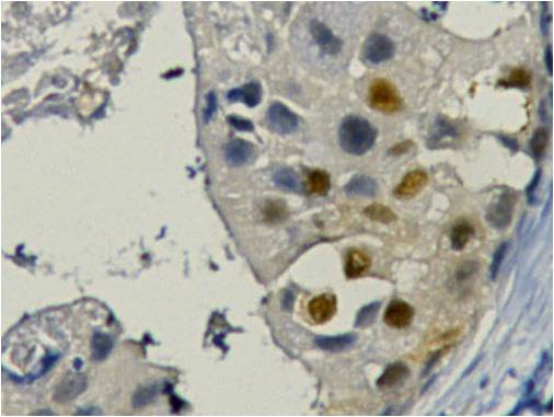 PCNA Monoclonal Antibody (12D10)